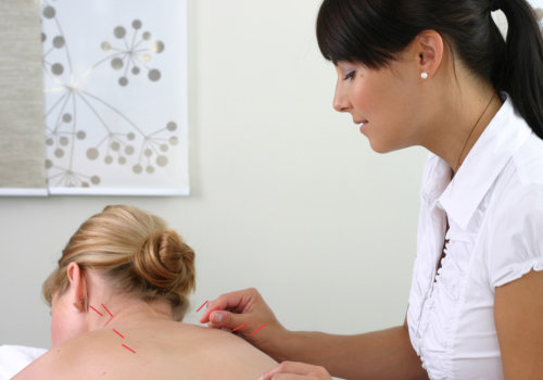 therapist performing acupuncture on client