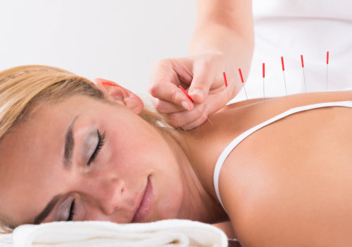acupuncture therapy on customer back at salon